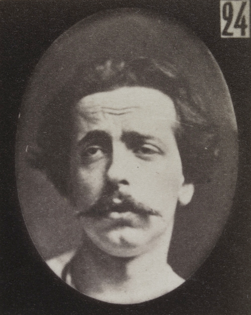 Illustration for article titled Terrifying, Century-Old Photographs from Neuroscience Experiments